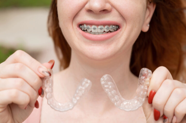 invisalign vs braces which orthodontic treatment