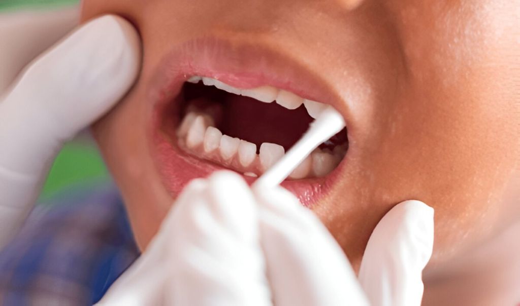 fluoride treatment & your child in coquitlam