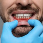 gum disease treatment in coquitlam
